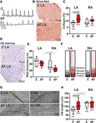 The inter-chamber differences in the contractile function between left and right atrial cardiomyocytes in atrial fibrillation in rats